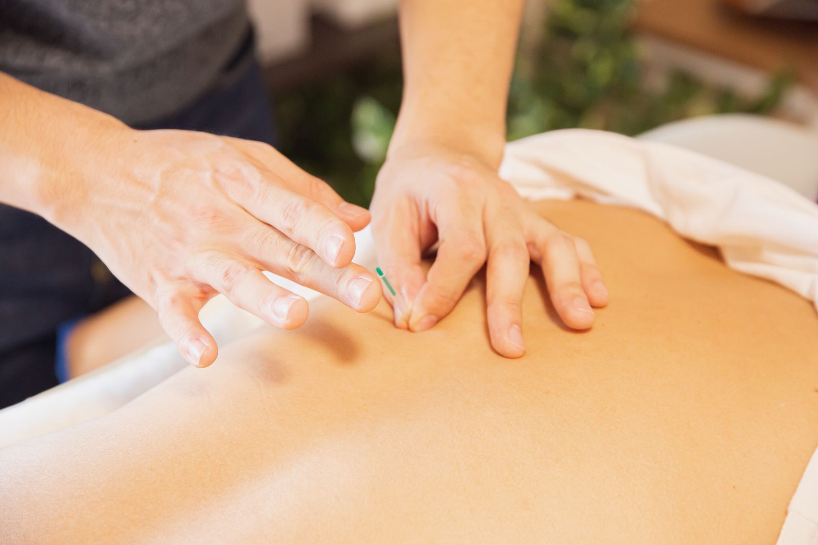 Dry Needling Heiloo